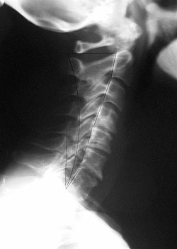 Fox Chiropractic