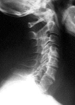 Fox Chiropractic